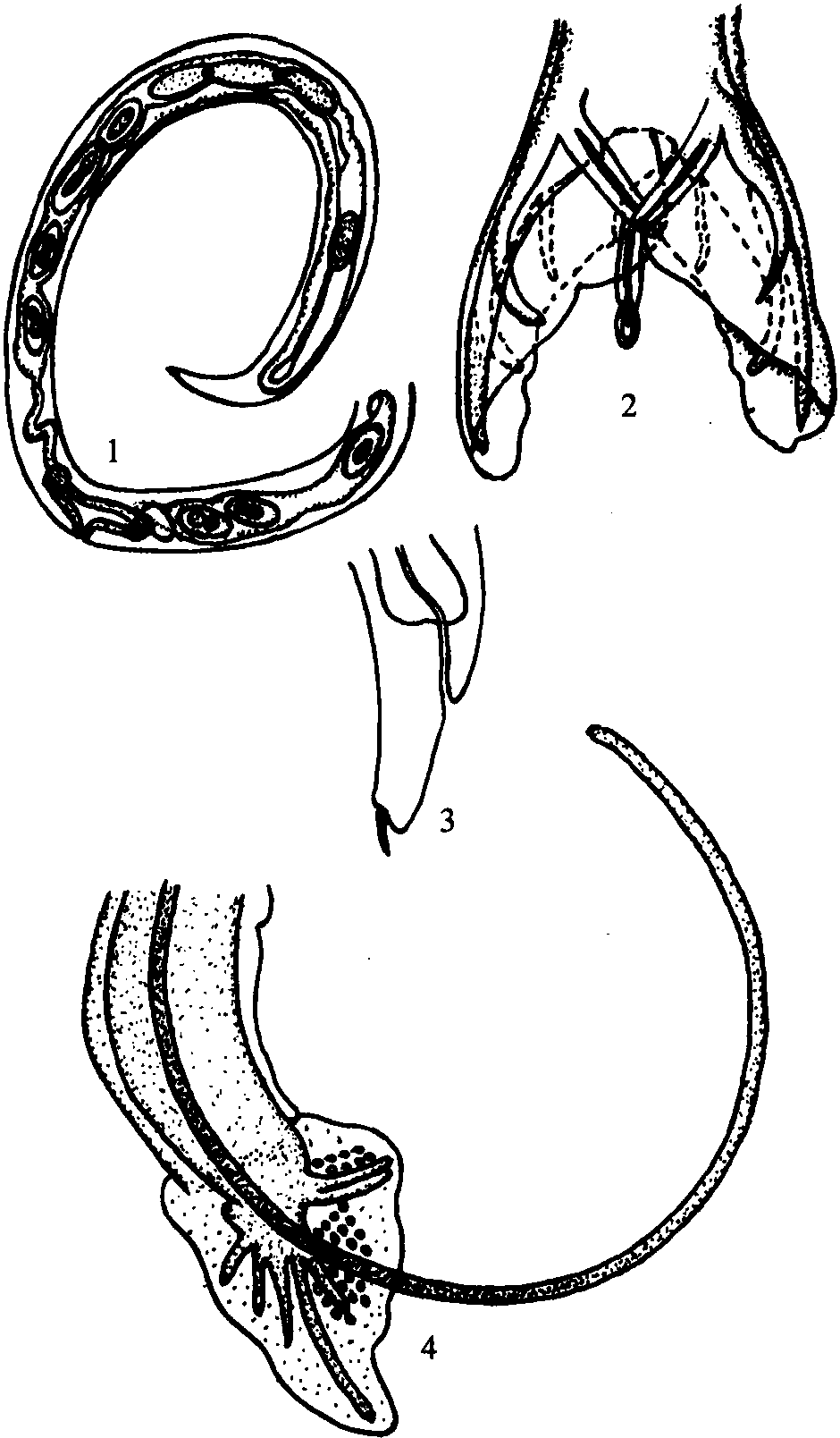 三角细颈线虫